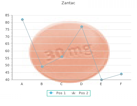 300mg zantac with mastercard